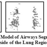 Figure 5: 3D Model of Airways Segmented from Inside of the Lung Region
