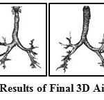 Figure 6: Sample Results of Final 3D Airway Segmentation