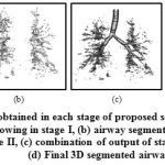 Figure 7: Results obtained in each stage of proposed scheme for Case 36:(a) simple region growing in stage I, (b) airway segmented from lung region in stage II, (c) combination of output of stage I & II, and (d) Final 3D segmented airway