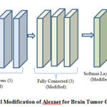 Figure 2: Overall Modification of Alexnet for Brain Tumor Classification