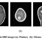 Figure 3: Brain MRI images (a): Pituitary (b): Glioma (c): Meningioma.