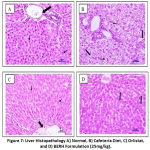 Figure 7: Liver Histopathology A) Normal, B) Cafeteria Diet, C) Orlistat, and D) BERH Formulation (25mg/kg).
