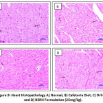 Figure 9: Heart Histopathology A) Normal, B) Cafeteria Diet, C) Orlistat, and D) BERH Formulation (25mg/kg).