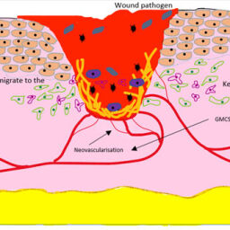 Growth Factors in Wound Healing – A Review – Biomedical and ...