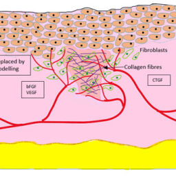 Growth Factors in Wound Healing – A Review – Biomedical and ...