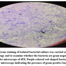 Isolation and Identification of Listeria Monocytogenes in Bangalore ...