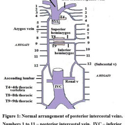 Unusual Course of Posterior Intercostal Vein at the 3rd Intercostal ...