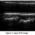 Vol15No3_Seg_Arct_fig3