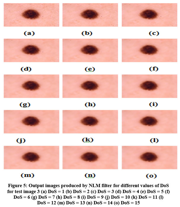 Preprocessing of Skin Cancer Images using Non-Local Means (Nlm) Filter ...
