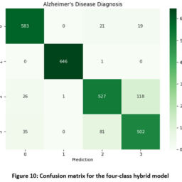 Hybrid Model: Deep Learning Method for Early Detection of Alzheimer’s ...