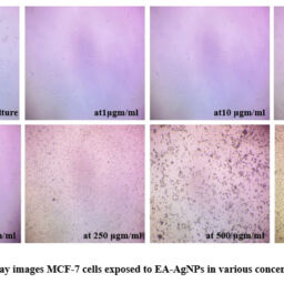 Antiproliferative Activity of Green Process Synthesized Epipremnum ...