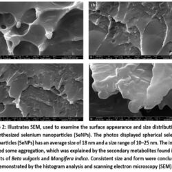 Bioinspired Selenium Nanoparticles as a Potential Anticancer Agent in ...