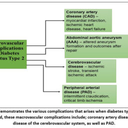 A Review on Type 2 Diabetes Mellitus: Pathophysiology, Risk Factors ...