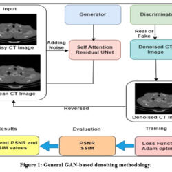 Generative Adversarial framework for CT image denoising using Self ...
