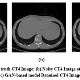 Generative Adversarial framework for CT image denoising using Self ...