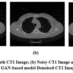 Generative Adversarial framework for CT image denoising using Self ...